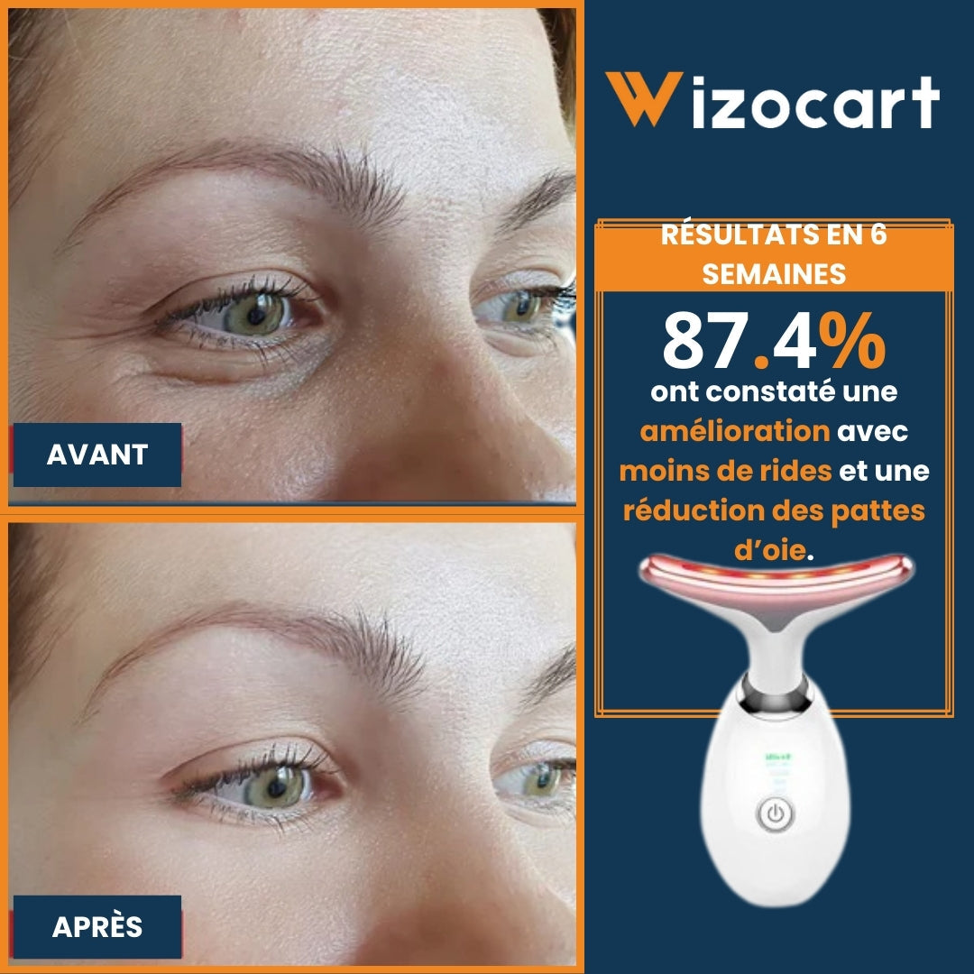 Appareil pour Anti-rides et lifting du visage